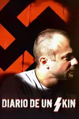 Diario de un skin