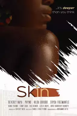 Skin